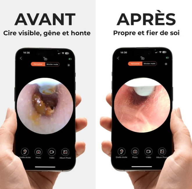 Auris Vision 1.0